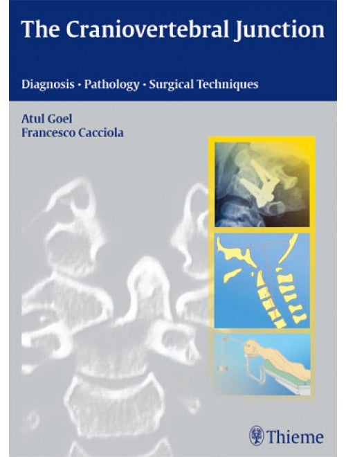 Craniovertebral Junction: Diagnosis - Pathology - Surgical Techniques  1ST/2010