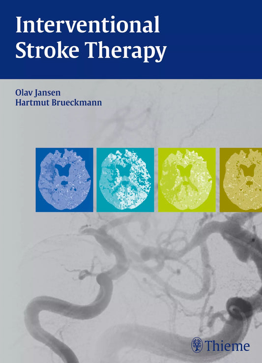 Interventional Stroke Therapy 1ST/2013