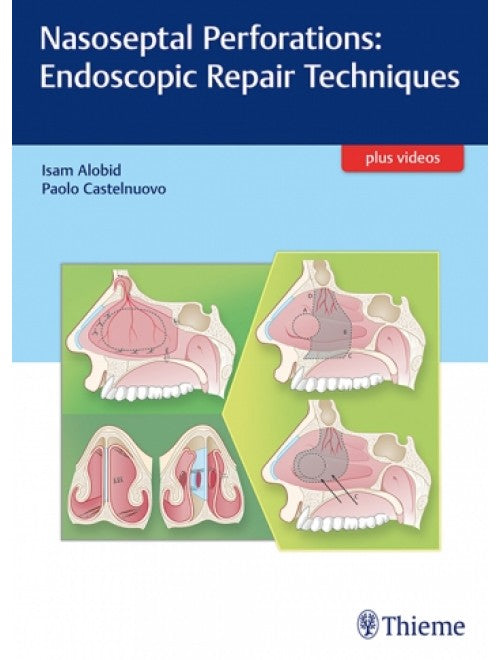 NASOSEPTAL PERFORATIONS ENDOSCOPIC REPAIR TECHNIQUES 1st/2017