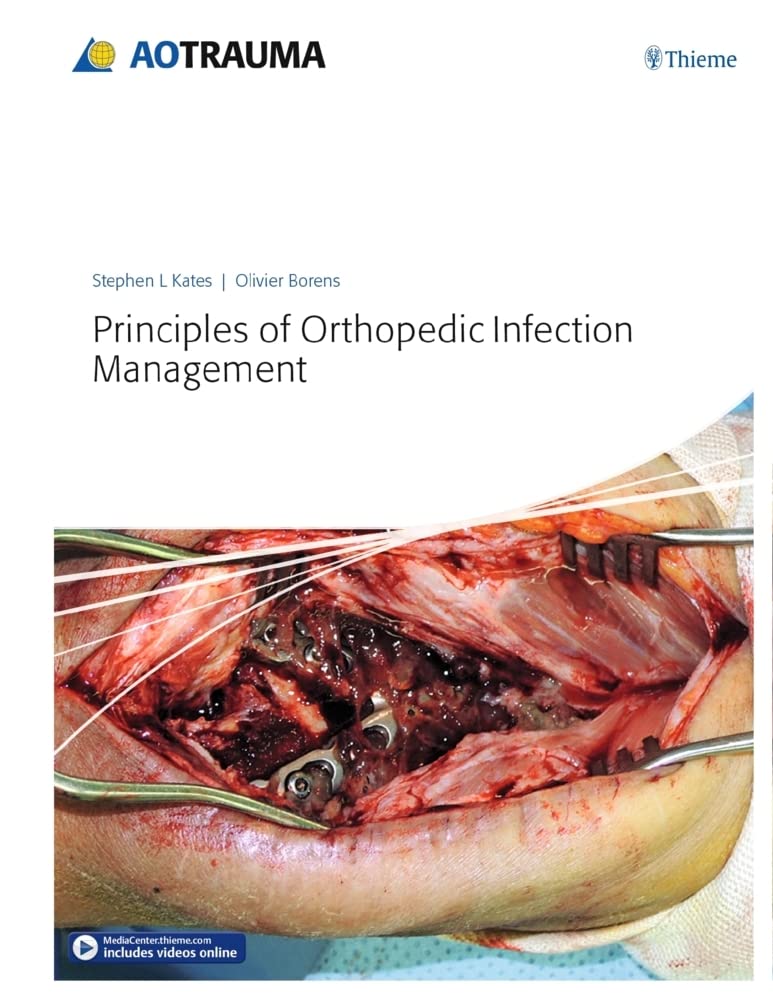 PRINCIPLES OF ORTHOPEDIC INFECTION MANAGEMENT 1ST/2016 - STEPHEN KATES