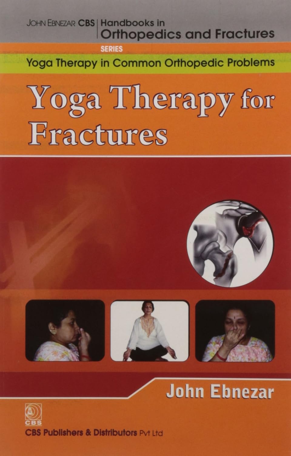 YOGA THERAPY IN FRACTURES 1E/2012