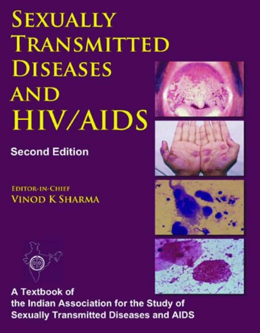 Sexually Transmitted Diseases and HIV/AIDS 2nd/2009