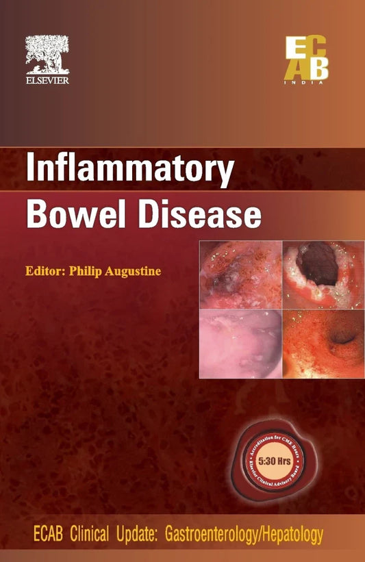 INFLAMMATORY BOWEL DISEASE 1E/2010