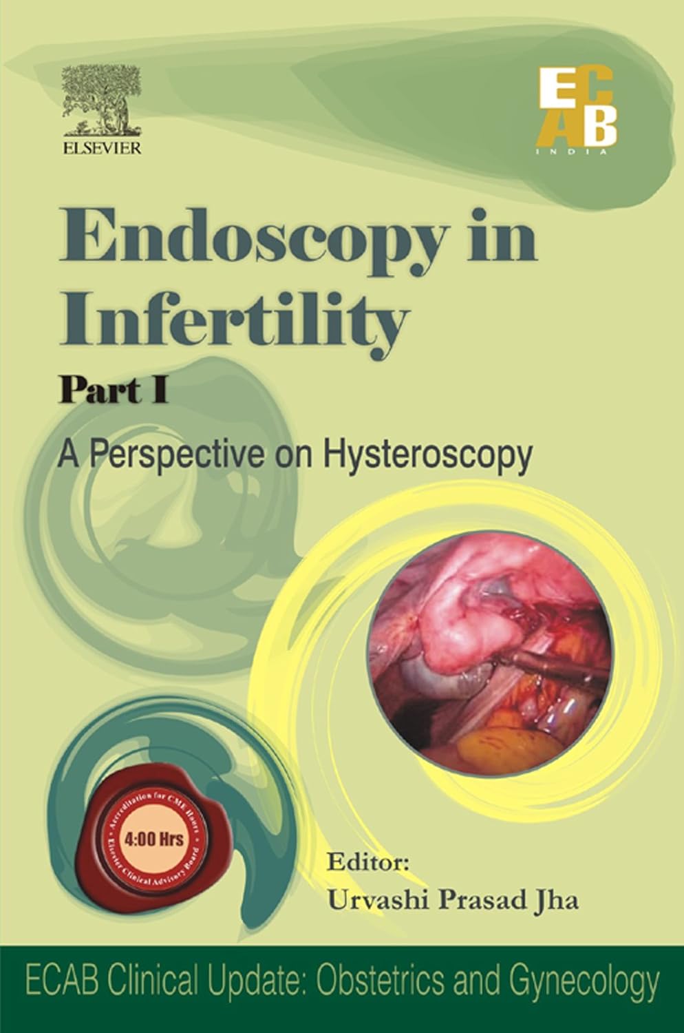 ENDOSCOPY IN INFERTILITY PART-1 1ST/2009-URVASHI PRASAD