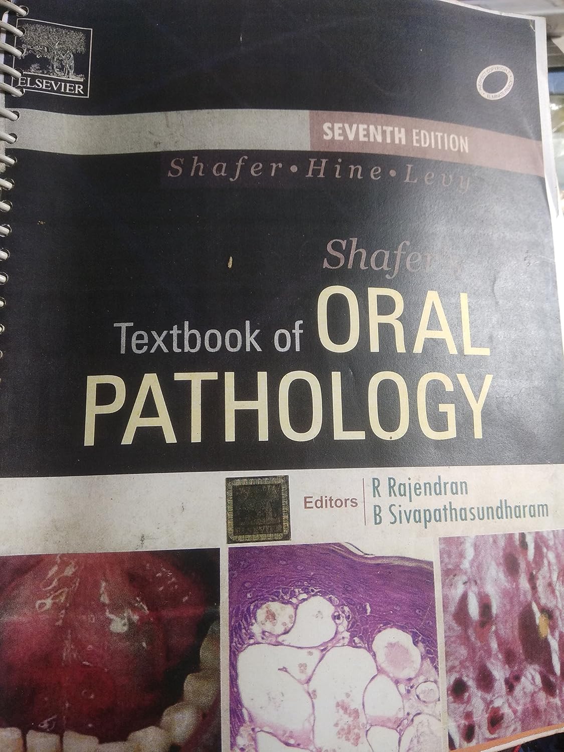 SHAFERS TEXTBOOK OF ORAL PATHOLOGY 7TH/2012 - RAJENDRAN