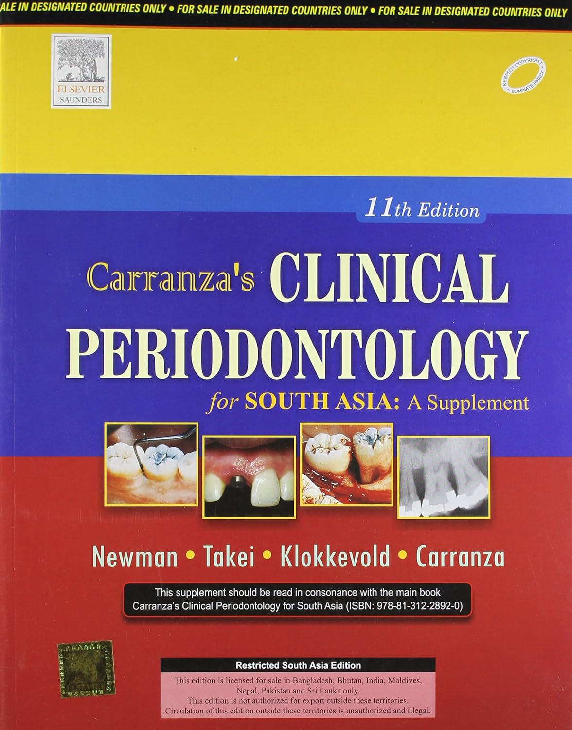 CARRANZA'S CLINICAL PERIODONTOLOGY 11TH/2013 SUPPLIMENTRY - NEWMAN