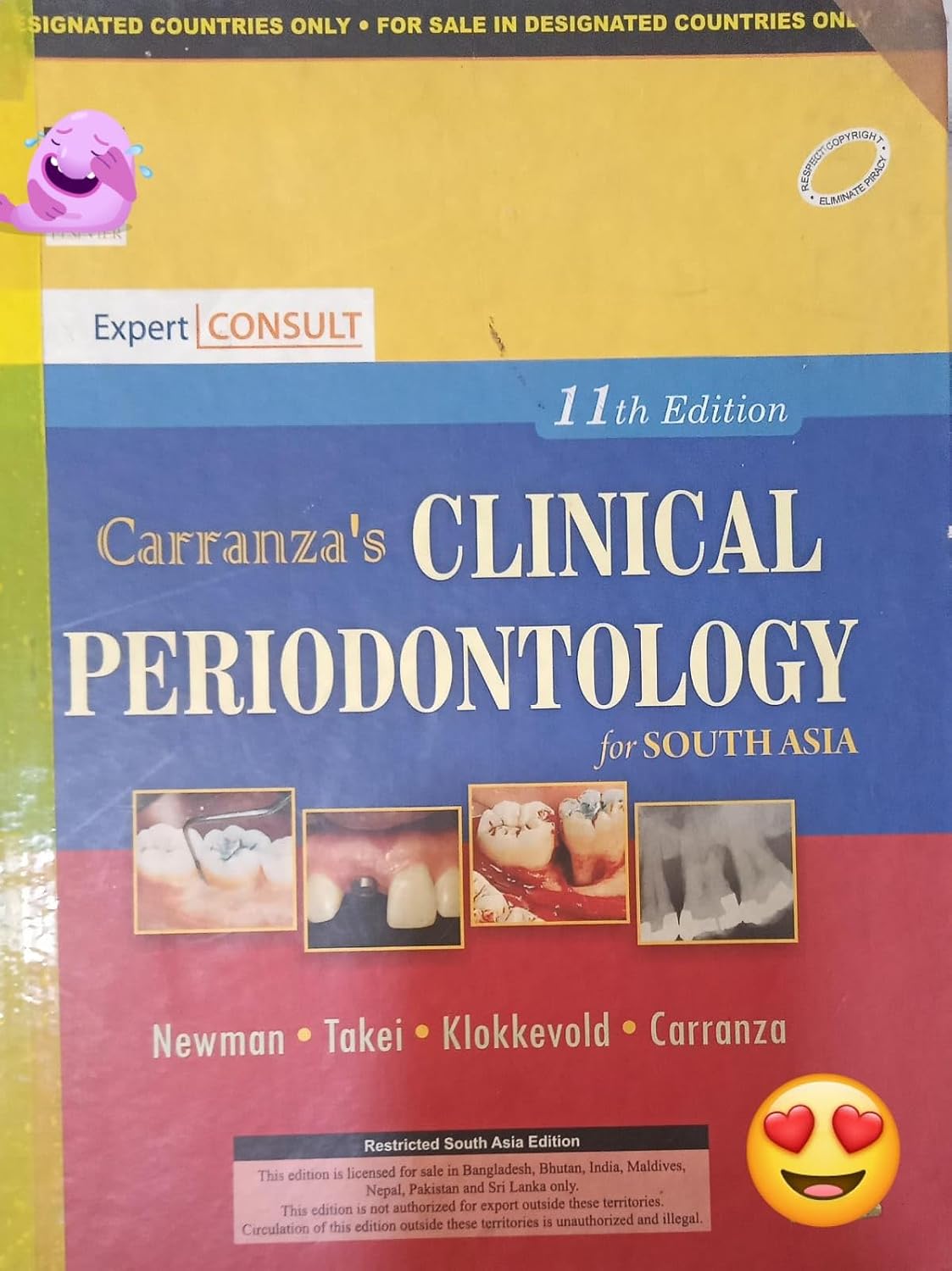 CARRANZAS CLINICAL PERIODONYTOLOGY 2 VOL SETS 11TH/2012 - NEWMAN