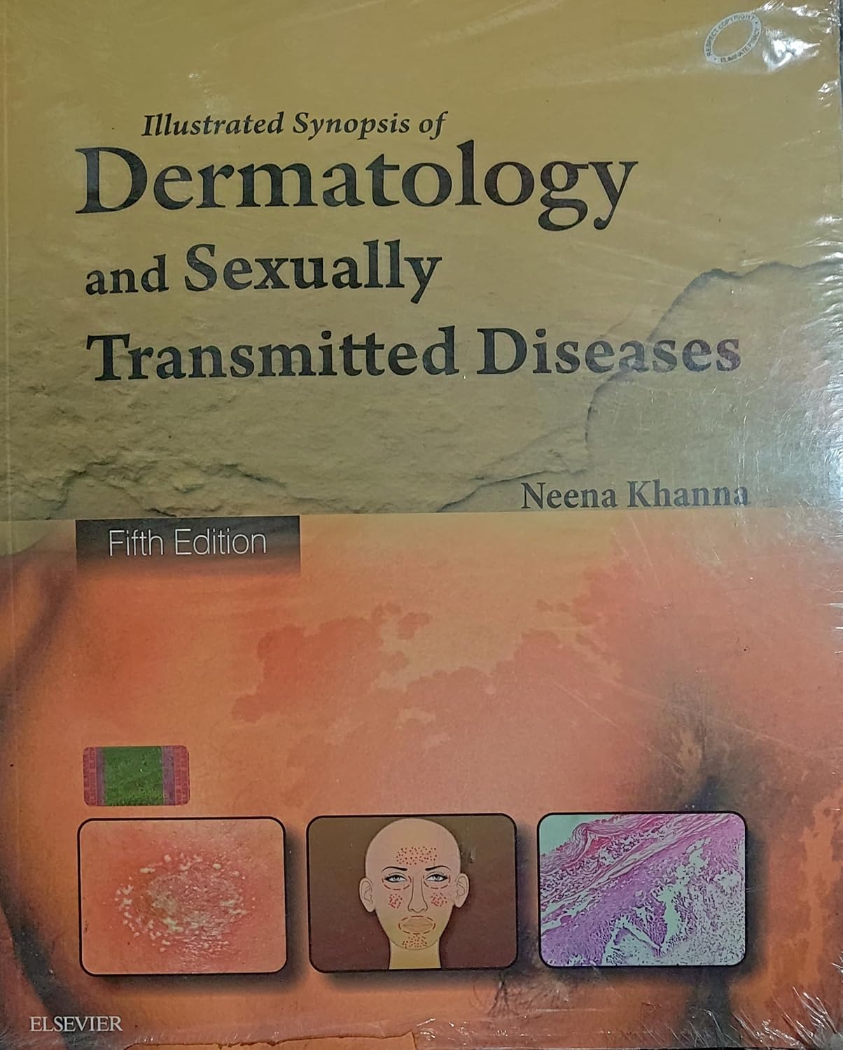 ILLUSTRATED SYNOPISIS OF DERMATOLOGY AND SEXUALLY TRANSMITTED DISEASES 5TH/2016- NEENA KHANNA