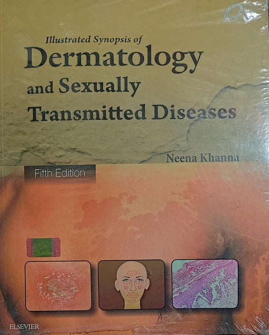 ILLUSTRATED SYNOPISIS OF DERMATOLOGY AND SEXUALLY TRANSMITTED DISEASES 5TH/2016- NEENA KHANNA