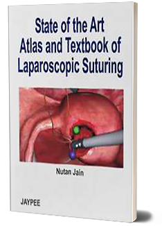 State of the Art Atlas and Textbook of Laparoscopic Suturing 1ST/2006