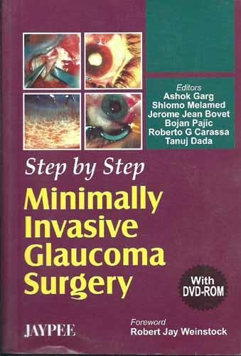 STEP BY STEP MINIMALLY INVASIVE GLAUCOMA SURGERY WITH DVD-ROM 1ST/2006 - ASHOK GARG