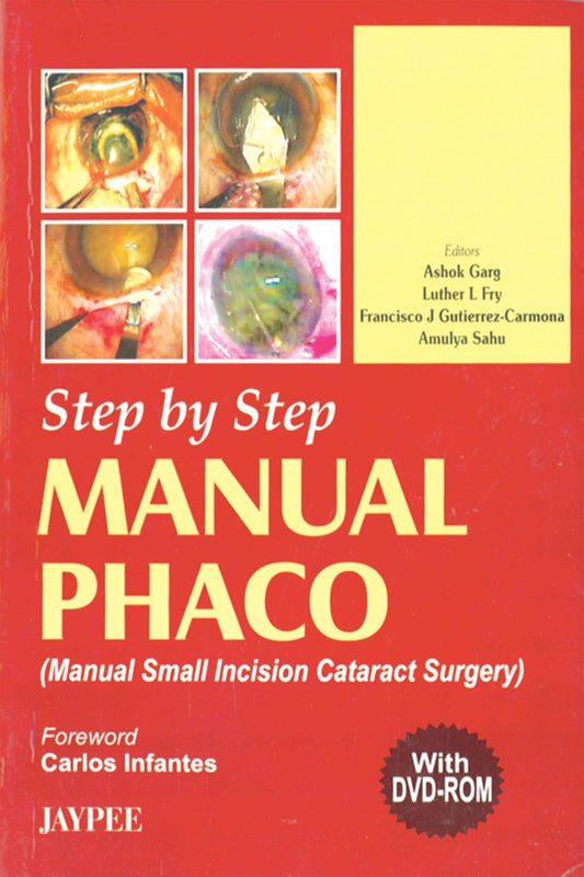 STEP BY STEP MANUAL PHACO WITH DVD-ROM 1ST/2006 - ASHOK GARG