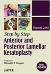 STEP BY STEP ANTERIOR AND POSTERIOR LAMELLAR KERATOPLASTY(WITH DVD) 1ST/2006 - THOMAS JOHN
