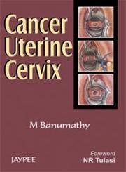 CANCER UTERINE CERVIX 1ST/2007 - BANUMATHY