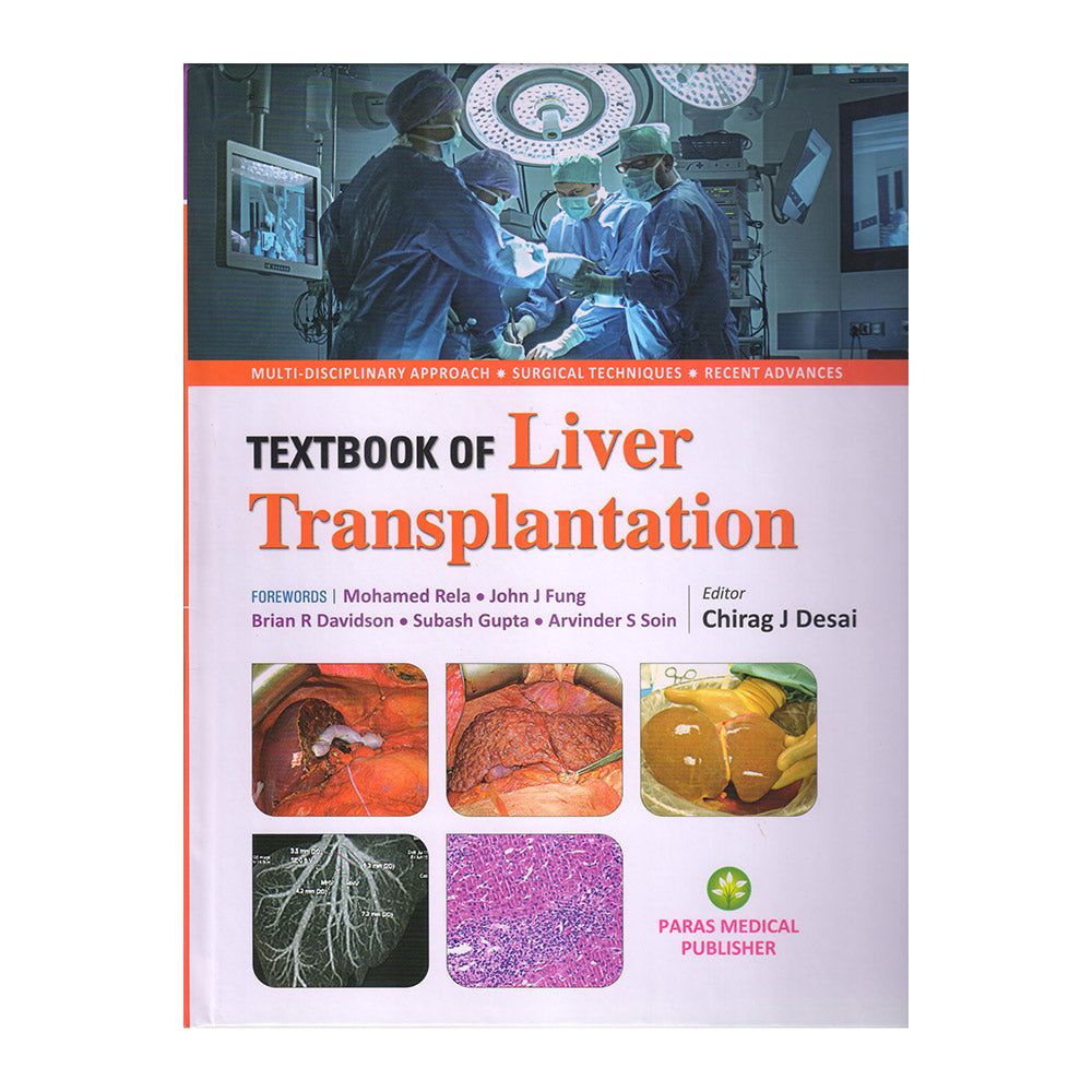 Textbook of Liver Transplantation 1st/2023