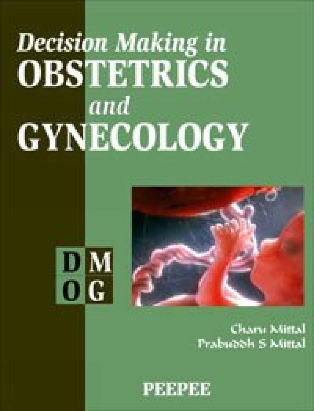 DECISION MAKING IN OBSTETRICS AND GYNECOLOGY 2ND/2012 - CHARU MITTAL