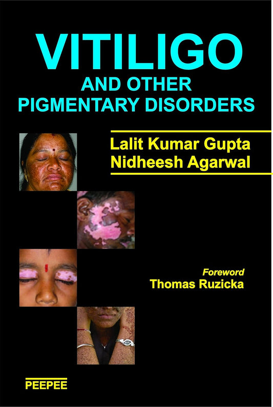 VITILIGO AND OTHER PIGMENTARY DISORDERS 1ST/2016-LALIT KUMAR GUPTA