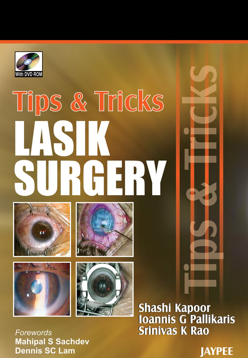 TIPS & TRICKS LASIK SURGERY WITH DVD ROM 1ST/2007 - SHASHI KAPOOR
