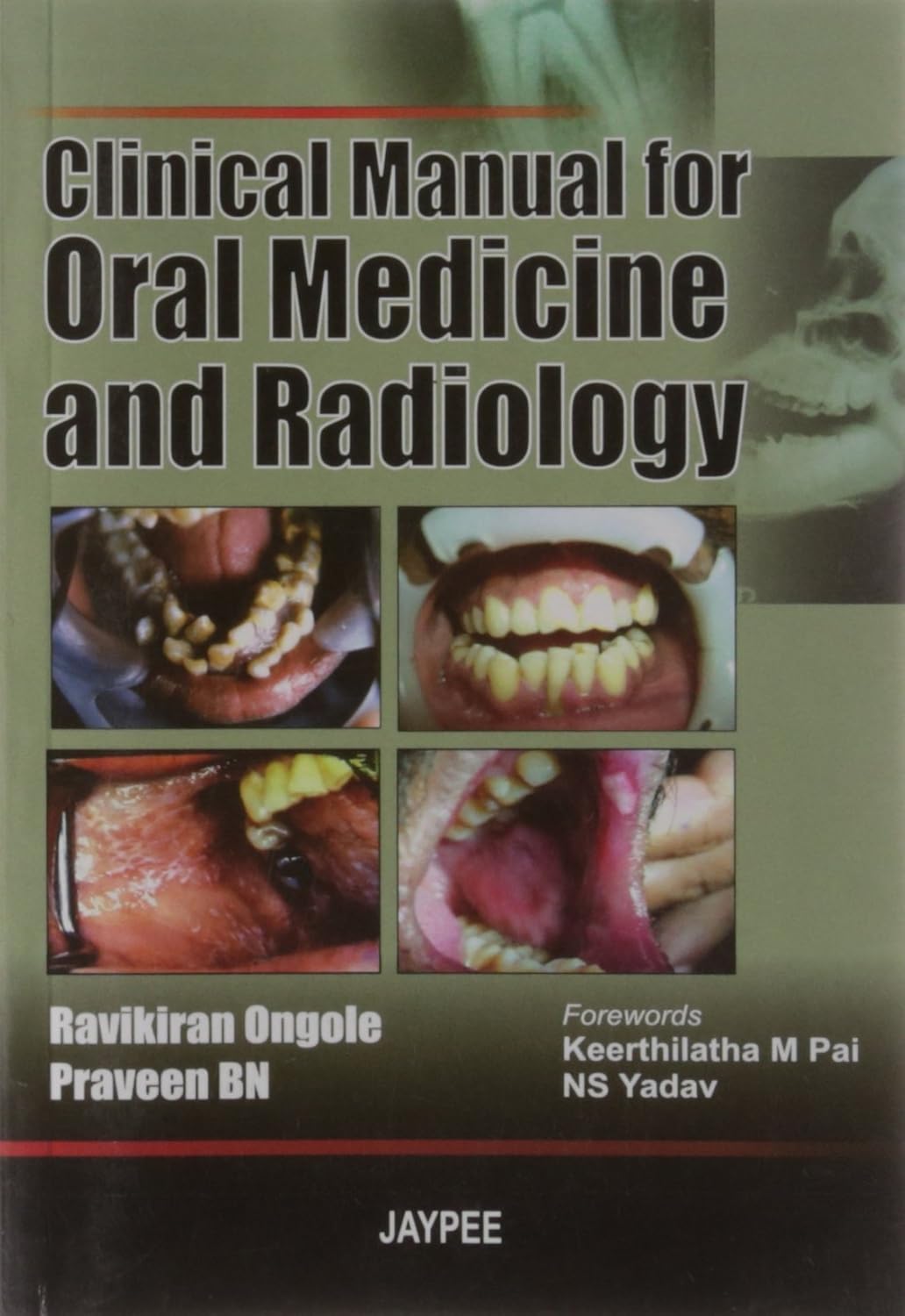CLINICAL MANUAL FOR ORAL MEDICINE AND RADIOLOGY 1ST/2007 - RAVIKIRAN ONGOLE