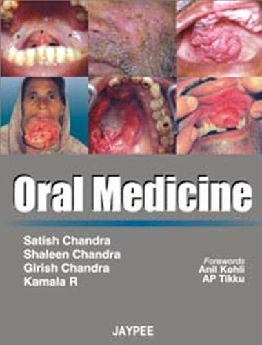 ORAL MEDICINE 1ST/2007 - SATISH CHANDRA