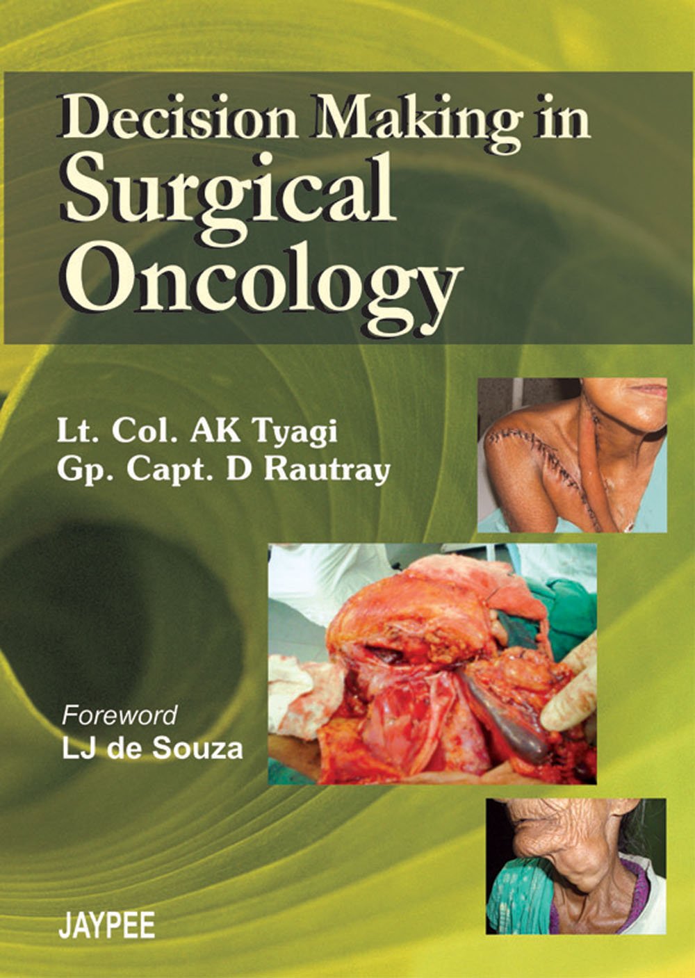 DECISION MAKING IN SURGICAL ONCOLOGY 1ST/2008 - AK TYAGI