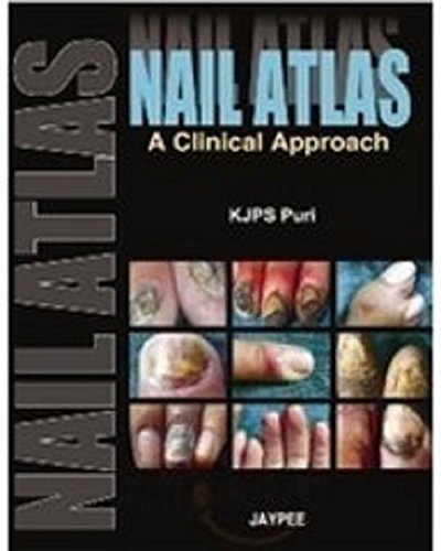 NAIL ATLAS A CLINICAL APPROACH 1ST/2008 - PURI