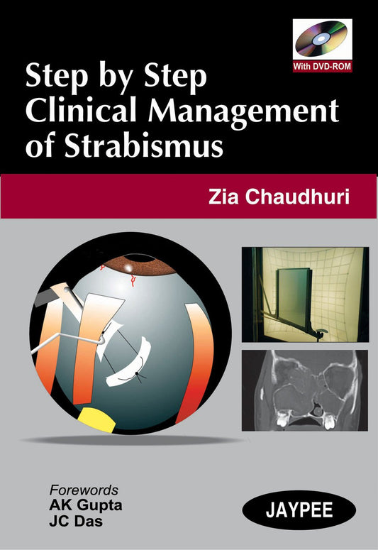 STEP BY STEP CLINICAL MANAGEMENT OF STRABISMUS WITH DVD-ROM 1ST/2008 - ZIA CHAUDHURI