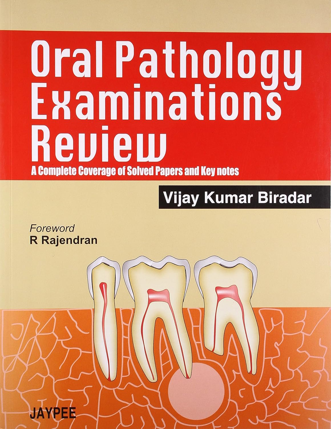 ORAL PATHOLOGY EXAMINATIONS REVIEW A COMPLETE COVERAGE OF SOLVED PAPERS AND KEY NOTES 1ST/2008 - VIJAY KUMAR BIRADAR