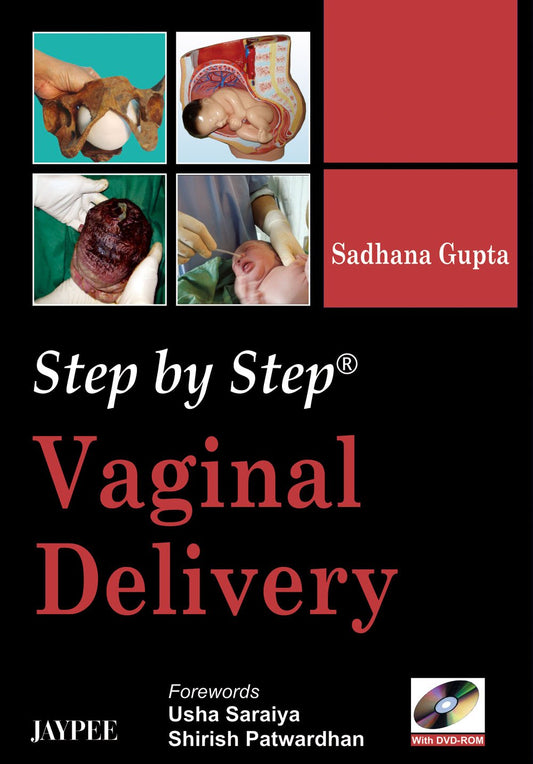 STEP BY STEP VAGINAL DELIVERY WITH DVD-ROM 1ST/2008 - SADHANA GUPTA