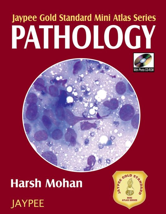 STEP BY STEP MANAGEMENT OF MENOPAUSE WITH DVD-ROM (DR.MALHOTRA'S SERIES) 1ST/2008 - MANINDER AHUJA