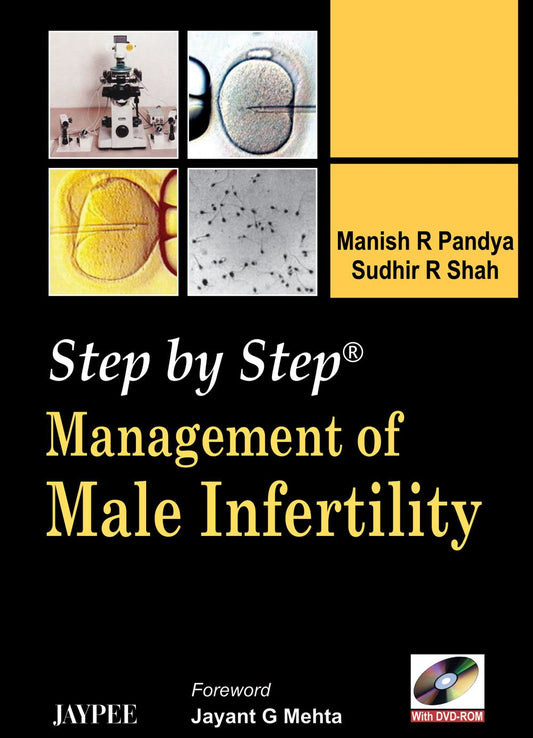 STEP BY STEP MANAGEMENT OF MALE INFERTILITY WITH DVD-ROM 1ST/2008 - MANISH R PANDYA