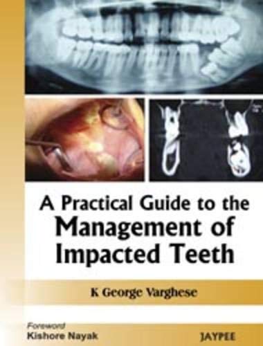 A PRACTICAL GUIDE TO THE MANAGEMENT OF IMPACTED TEETH 1ST/2010 - K GEORGE VARGHESE