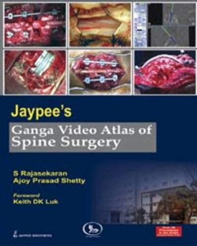 JAYPEE'S GANGA VIDEO ATLAS OF SPINE SURGERY OVER 50 PROC.IN 6 DVDS 1ST/2010 - S RAJASEKARAN