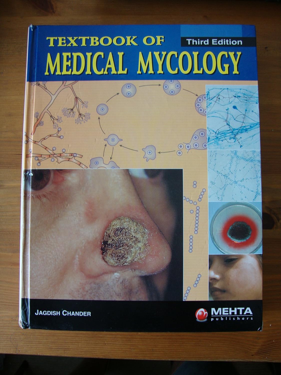 TEXTBOOK OF MEDICAL MYCOLOGY 3RD/2009 - JAGDISH CHANDER