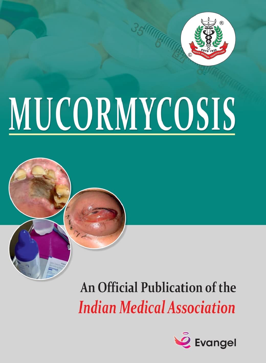 MUCORMYCOSIS 1E/2022