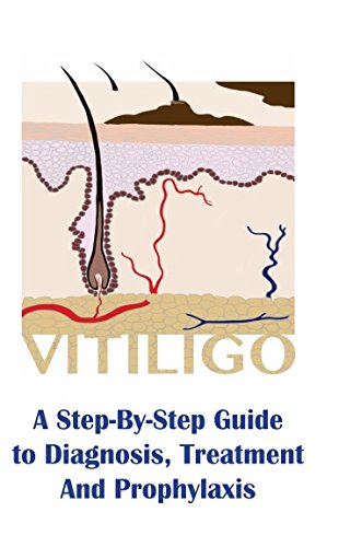 VITILIGO A STEP BY STEP GUIDE TO DIAGNOSIS TREATMENT AND PROPHYLAXIS 1ST/2018 - YAN VALLE