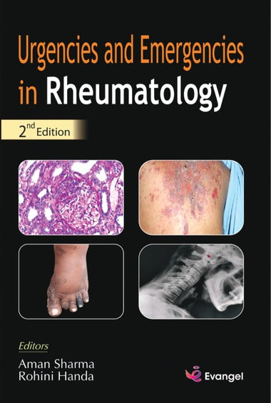 URGENCIES AND EMERGENCIES IN RHEUMATOLOGY 2ND/2021 - AMAN SHARMA