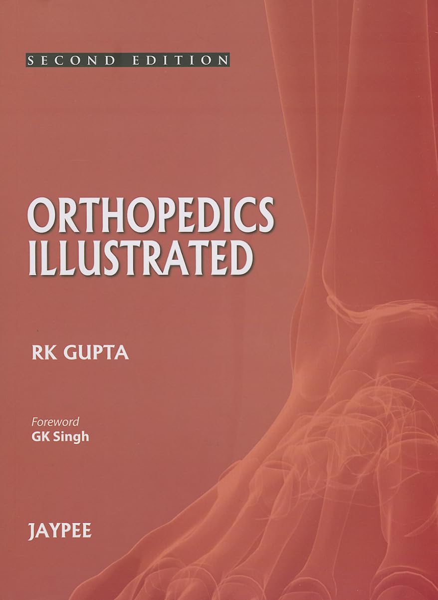 ORTHOPEDICS ILLUSTRATED 2ND/2013 - RK GUPTA