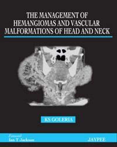THE MANAGEMENT OF HEMANGIOMAS AND VASCULAR MALFORMATIONS OF HEAD AND NECK 1ST/2012 - DHIMANT GOLERIA