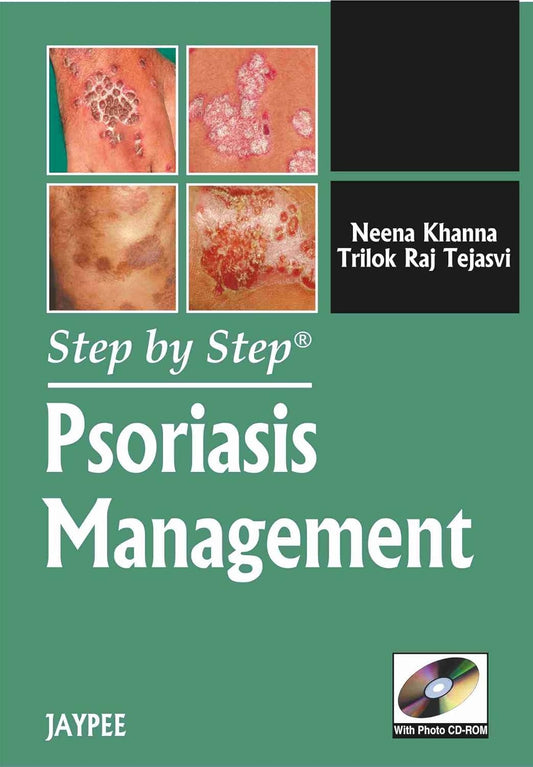STEP BY STEP PSORIASIS MANAGEMENT WITH PHOTO CD-ROM 1ST/2012 - NEENA KHANNA