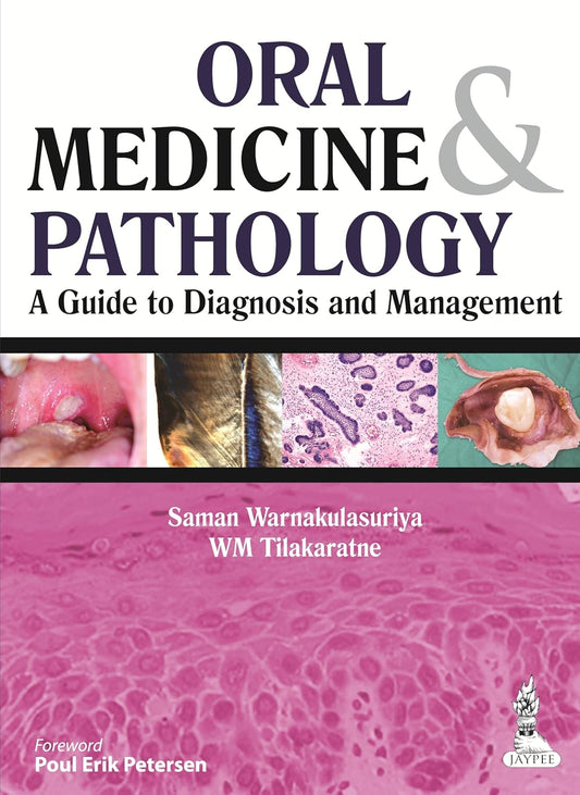 ORAL MEDICINE & PATHOLOGY A GUIDE TO DIAGNOSIS AND MANAGEMENT 1ST/2014 - SAMAN WARNAKULASURIYA