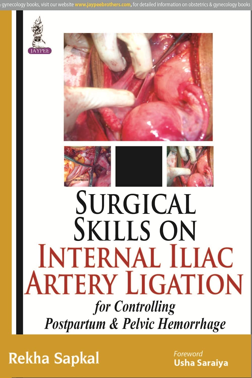 SURGICAL SKILLS ON INTERNAL ILIAC ARTERY LIGATION:FOR CONTROLLING POSTPARTUM & PELVIC HEMORRHAGE 1ST/2015 - REKHA SAPKAL