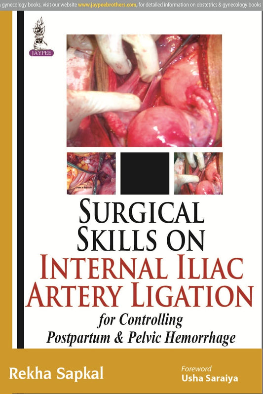 SURGICAL SKILLS ON INTERNAL ILIAC ARTERY LIGATION:FOR CONTROLLING POSTPARTUM & PELVIC HEMORRHAGE 1ST/2015 - REKHA SAPKAL
