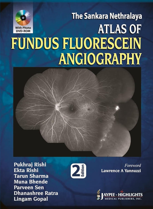 THE SANKARA NETHRALAYA ATLAS OF FUNDUS FLUORESCEIN ANGIOGRAPHY WITH PHOTO DVD-ROM 2ND/2013 - PUKHRAJ RISHI