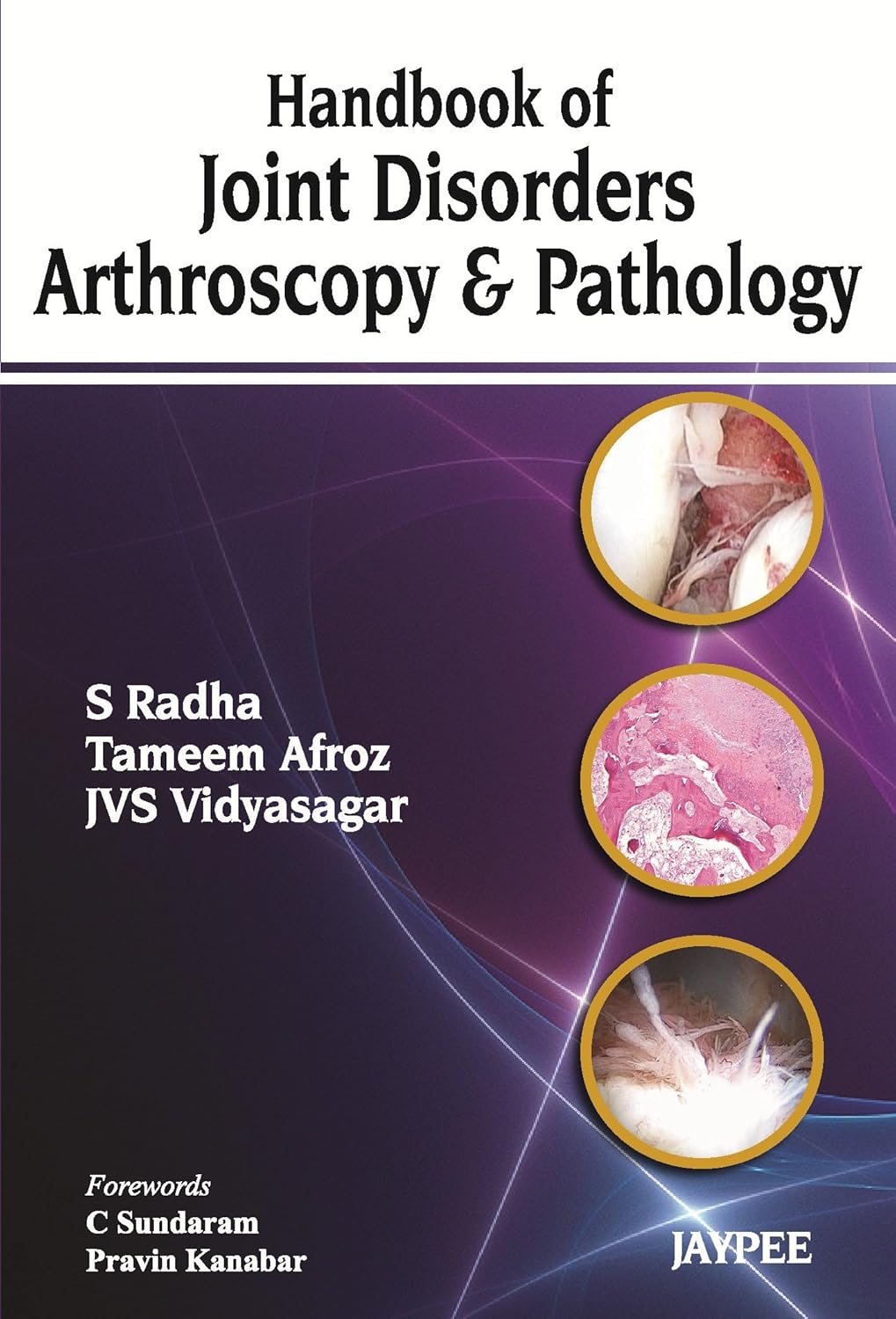 HANDBOOK OF JOINT DISORDERS ARTHROSCOPY & PATHOLOGY 1ST/2013 - S RADHA