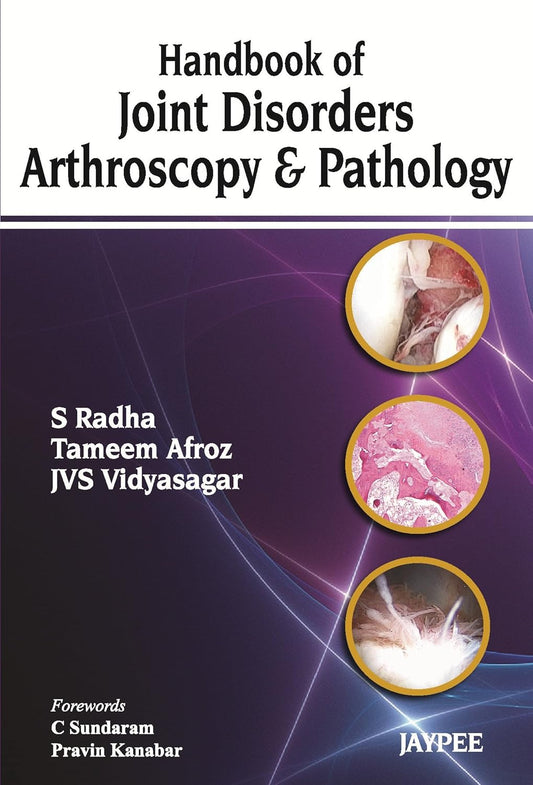HANDBOOK OF JOINT DISORDERS ARTHROSCOPY & PATHOLOGY 1ST/2013 - S RADHA