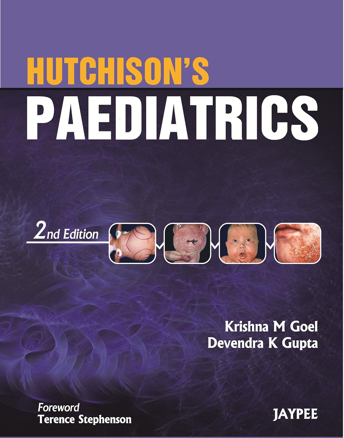 HUTCHISON'S PAEDIATRICS 2ND/2026 - KRISHNA M GOEL