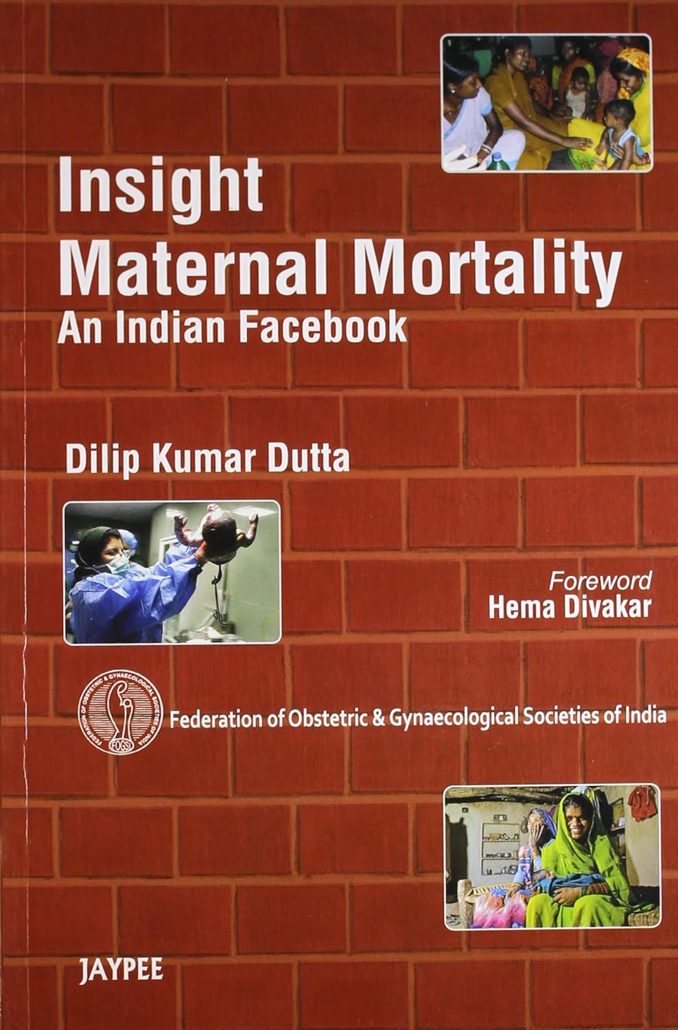 INSIGHT MATERNAL MORTALITY AN INDIAN FACEBOOK(FEDERATION OF OBS&GYN SOCIETIES OF INDIA) 1ST/2012 - DILIP KUMAR DUTTA