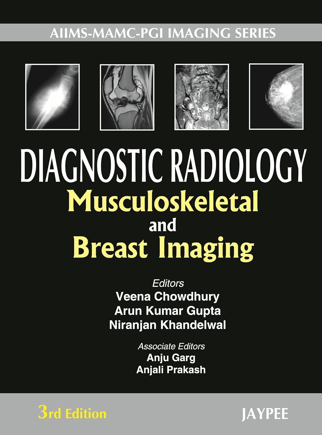 AIIMS MAMC PGI IMAGING SERIES DIAGNOSTIC RADIOLOGY MUSCULOSKELETAL AND BREAST IMAGING 3RD/2012 - VEENA CHOWDHURY