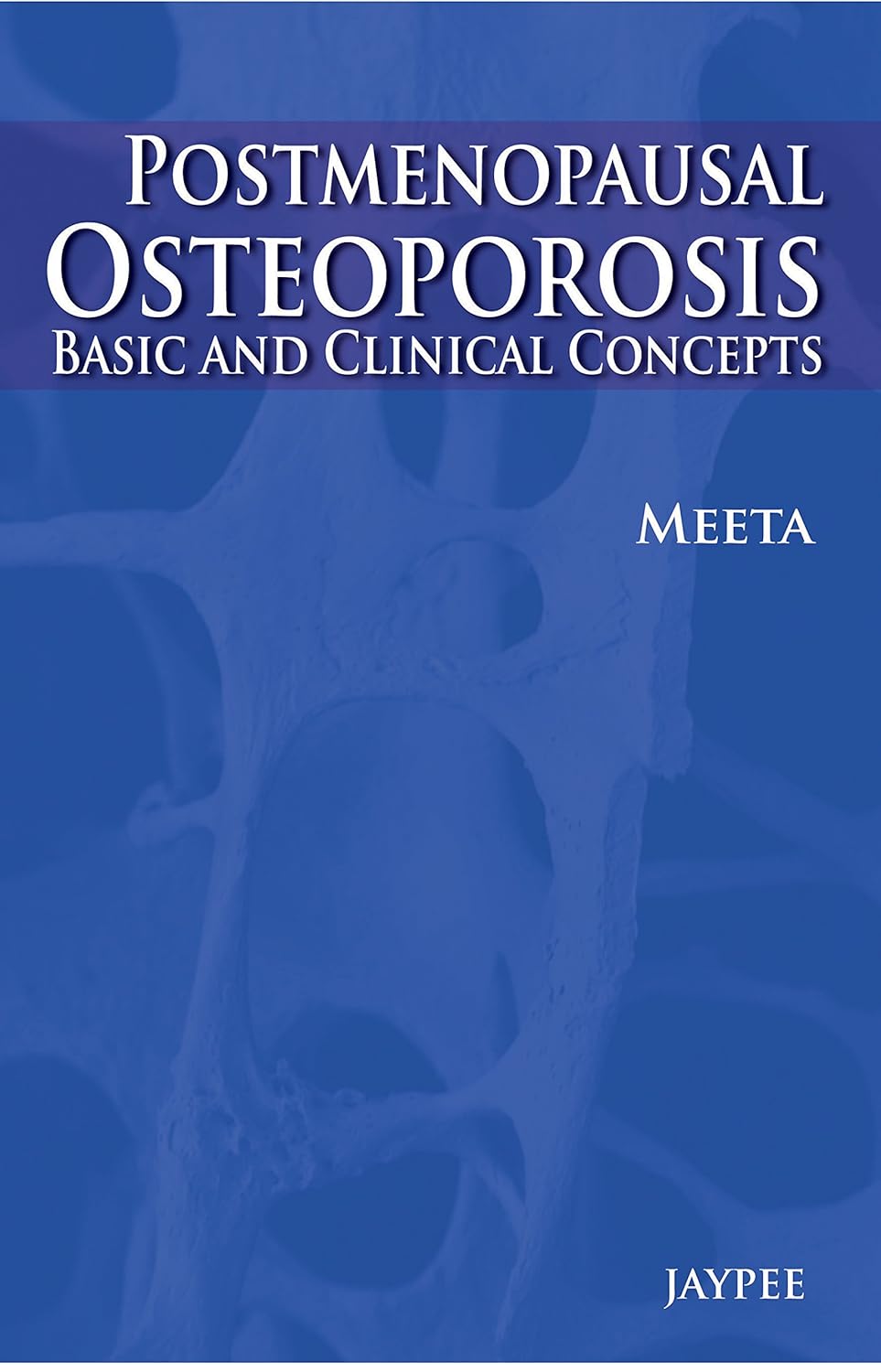POSTMENOPAUSAL OSTEOPOROSIS BASIC & CLINICAL CONCEPTS 1ST/2013 - MEETA
